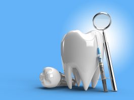 Dental Implants